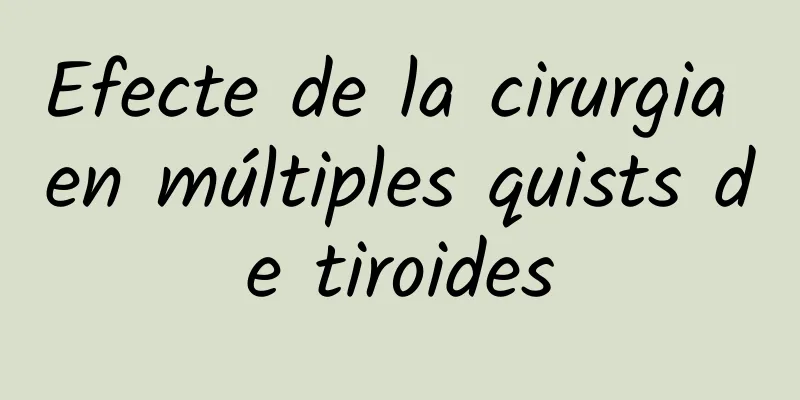 Efecte de la cirurgia en múltiples quists de tiroides
