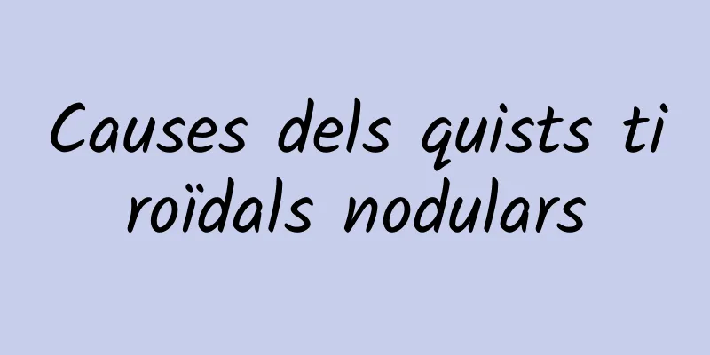 Causes dels quists tiroïdals nodulars