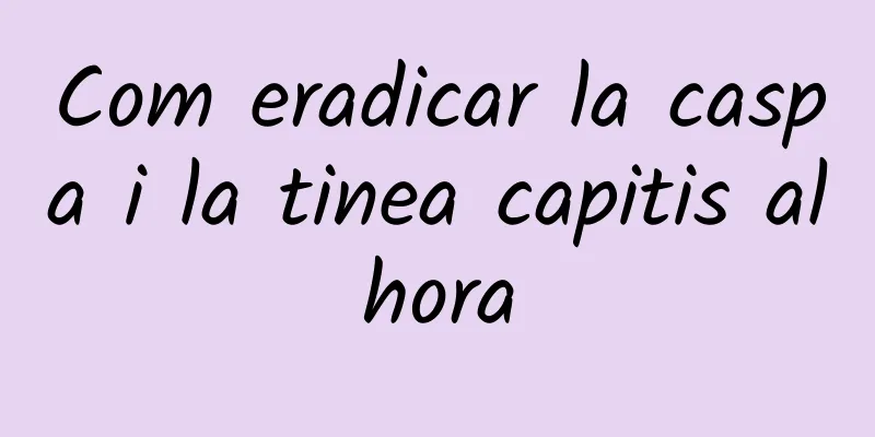 Com eradicar la caspa i la tinea capitis alhora