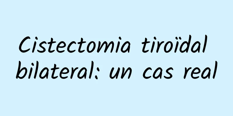 Cistectomia tiroïdal bilateral: un cas real
