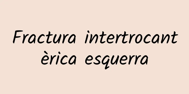 Fractura intertrocantèrica esquerra