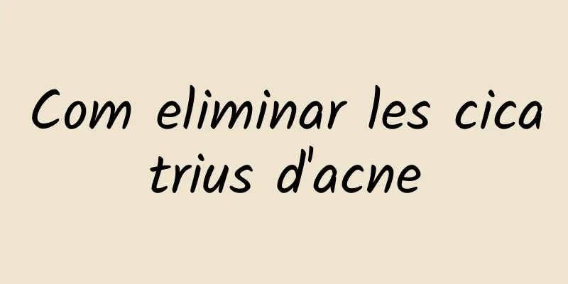 Com eliminar les cicatrius d'acne