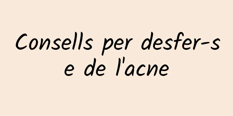 Consells per desfer-se de l'acne