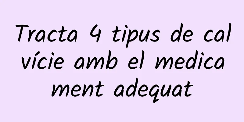Tracta 4 tipus de calvície amb el medicament adequat