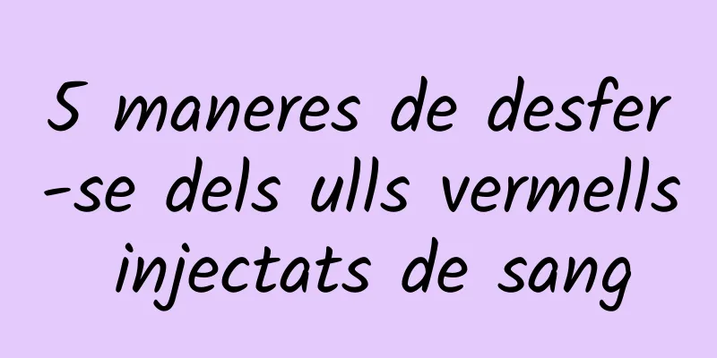 5 maneres de desfer-se dels ulls vermells injectats de sang