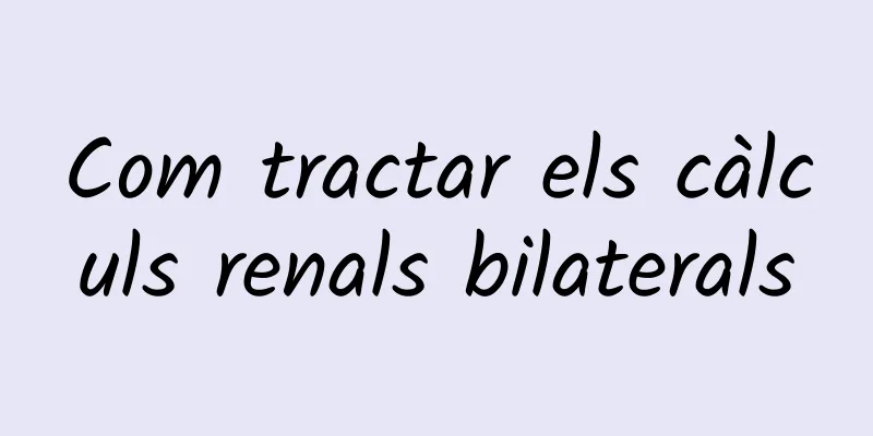 Com tractar els càlculs renals bilaterals