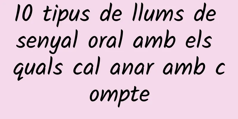 10 tipus de llums de senyal oral amb els quals cal anar amb compte