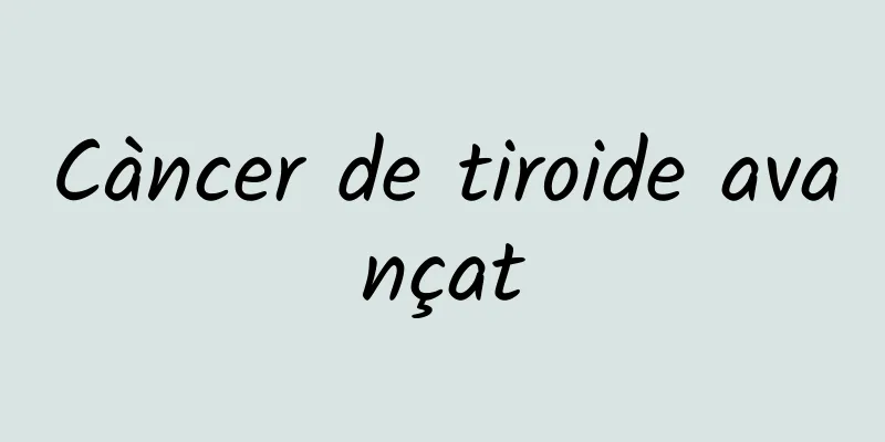 Càncer de tiroide avançat