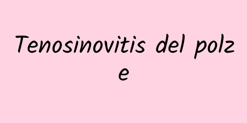 Tenosinovitis del polze
