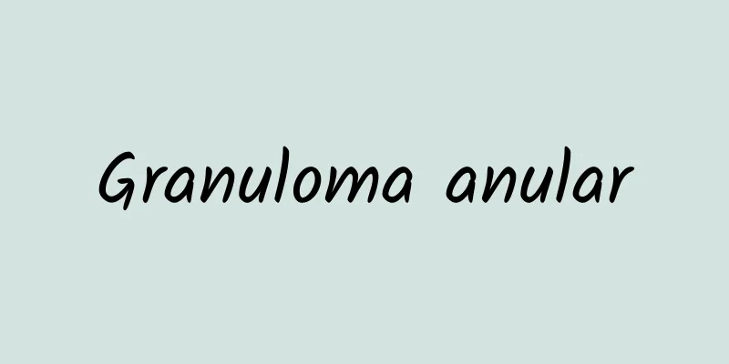 Granuloma anular