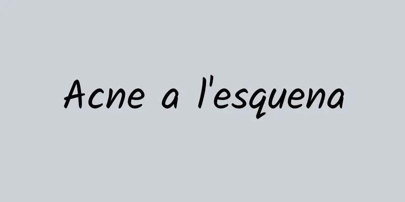 Acne a l'esquena