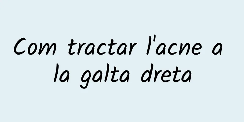 Com tractar l'acne a la galta dreta