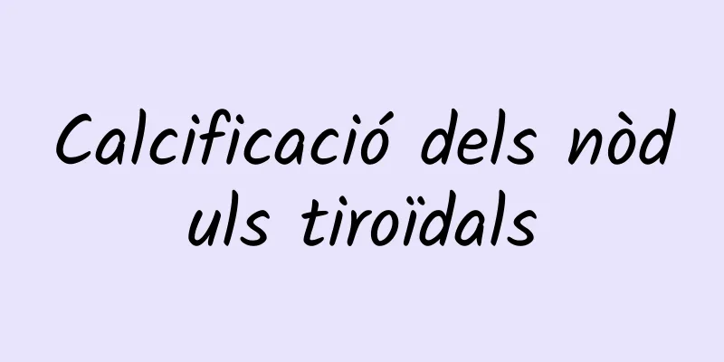 Calcificació dels nòduls tiroïdals