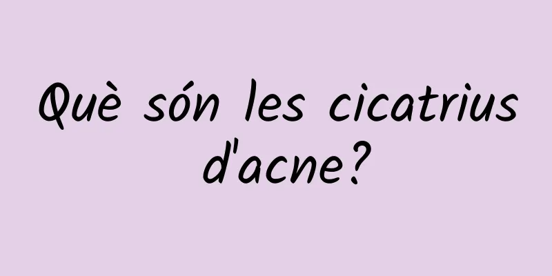 Què són les cicatrius d'acne?