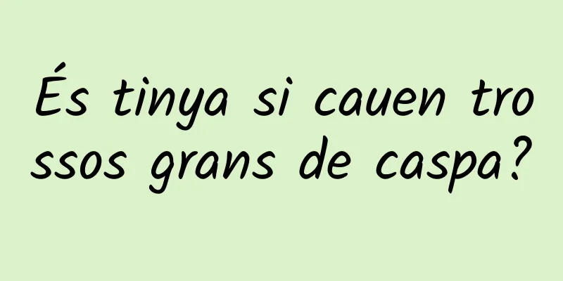 És tinya si cauen trossos grans de caspa?