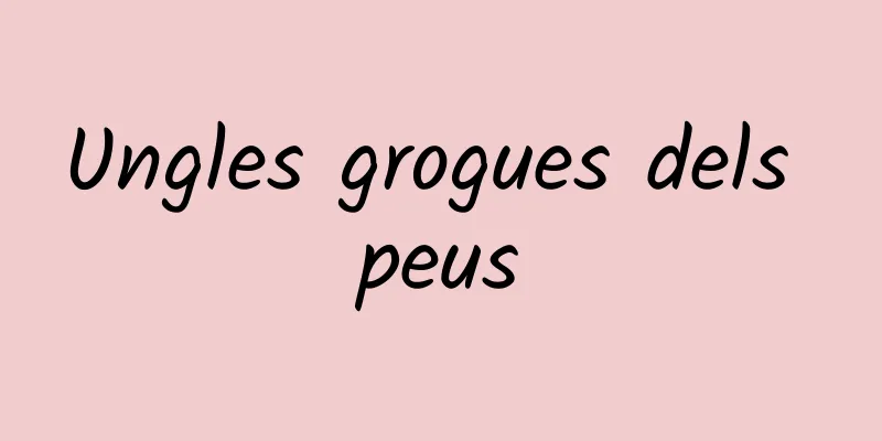 Ungles grogues dels peus