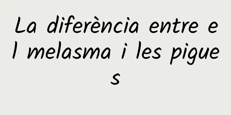 La diferència entre el melasma i les pigues
