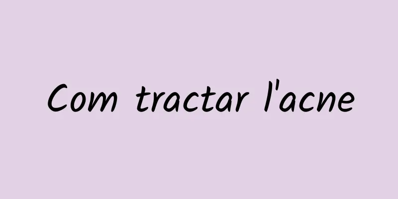 Com tractar l'acne