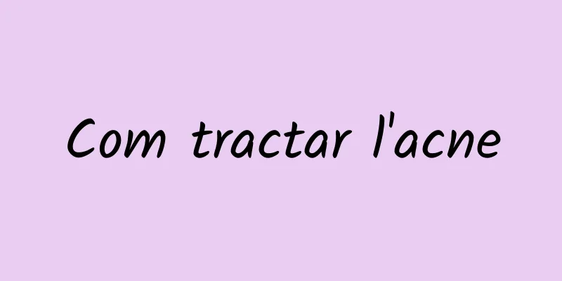 Com tractar l'acne