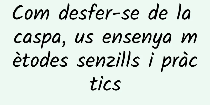 Com desfer-se de la caspa, us ensenya mètodes senzills i pràctics