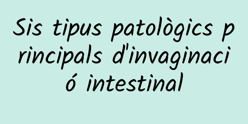 Sis tipus patològics principals d'invaginació intestinal